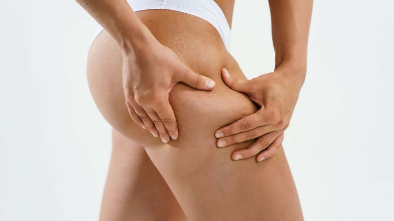 3 alimentos que te ayudarán a combatir la celulitis